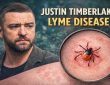 justin timberlake lyme disease