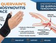 de quervain's tenosynovitis brace