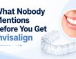 What Nobody Mentions Before You Get Invisalign