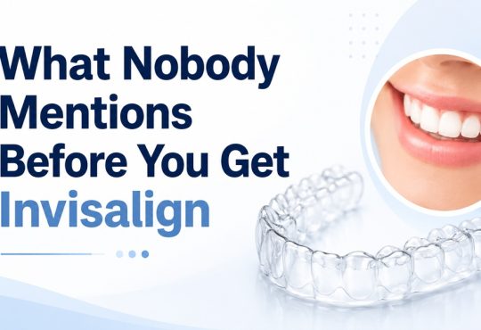 What Nobody Mentions Before You Get Invisalign