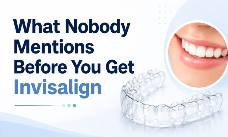 What Nobody Mentions Before You Get Invisalign