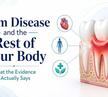 Gum Disease