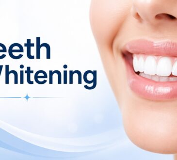 Teeth Whitening