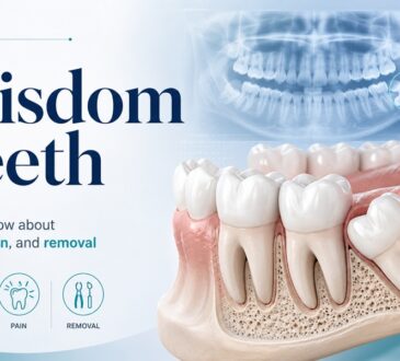 Wisdom Teeth